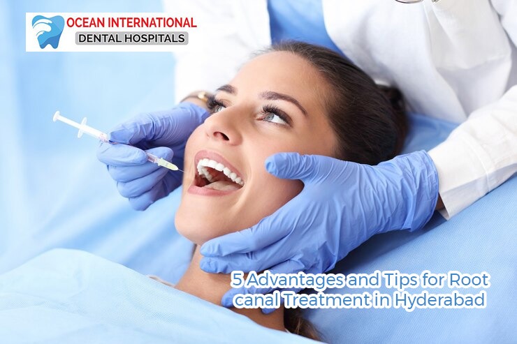 5 Advantages and Tips for Root canal Treatment in Hyderabad