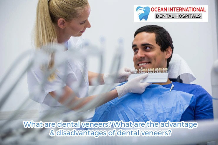 What are dental veneers? What are the advantage & disadvantages of dental veneers?