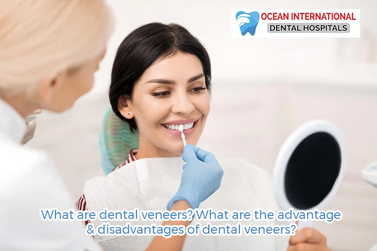 What are dental veneers? What are the advantage & disadvantages of dental veneers?