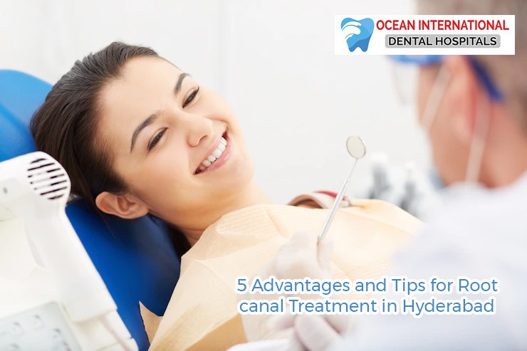 5 Advantages and Tips for Root canal Treatment in Hyderabad