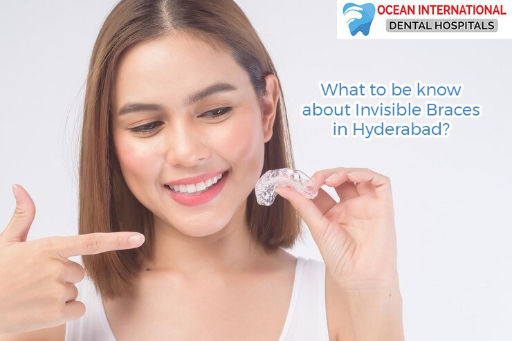 What to be know about Invisible Braces in Hyderabad?