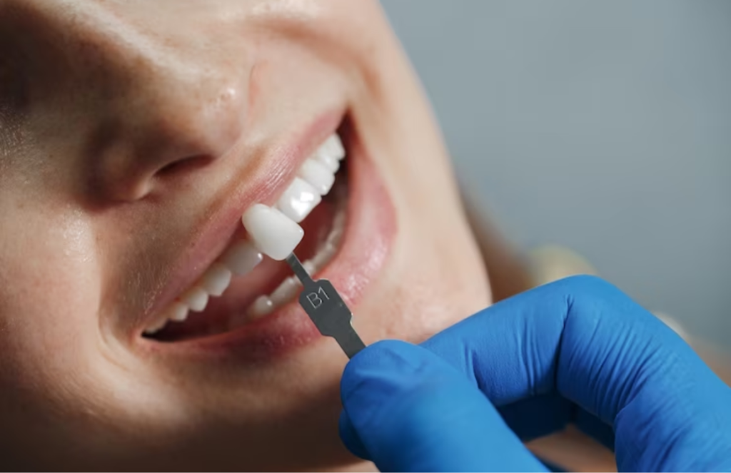 What to know about cosmetic dentistry hospital Hyderabad?