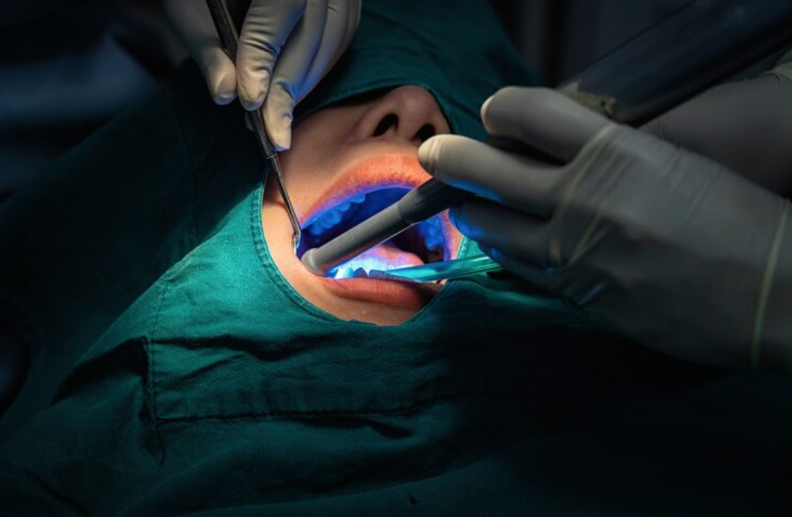 Advantages of Laser Dentistry in Dental Procedures