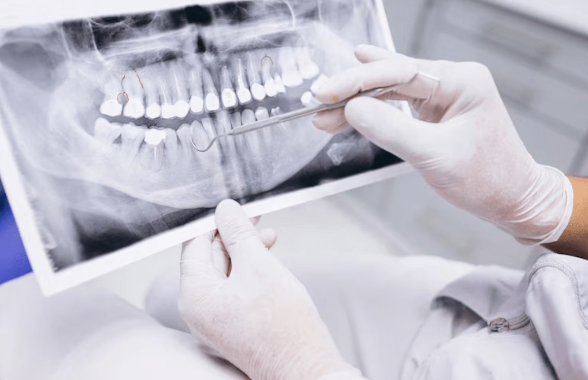 The Role of Dental Radiology in Diagnosis and Treatment