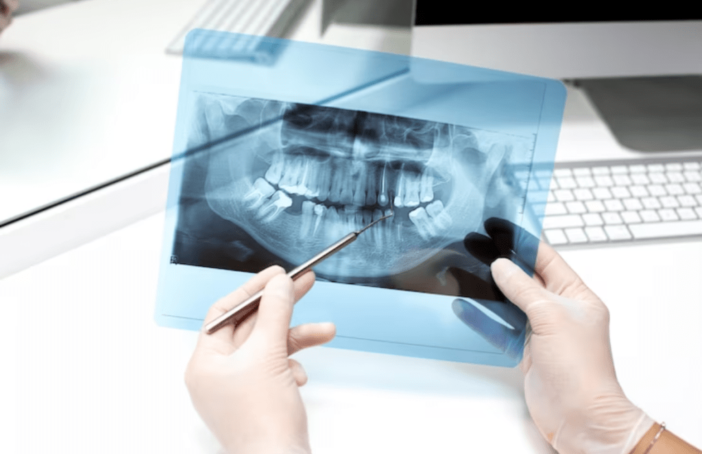 The Importance of Dental X-Rays in Oral Health