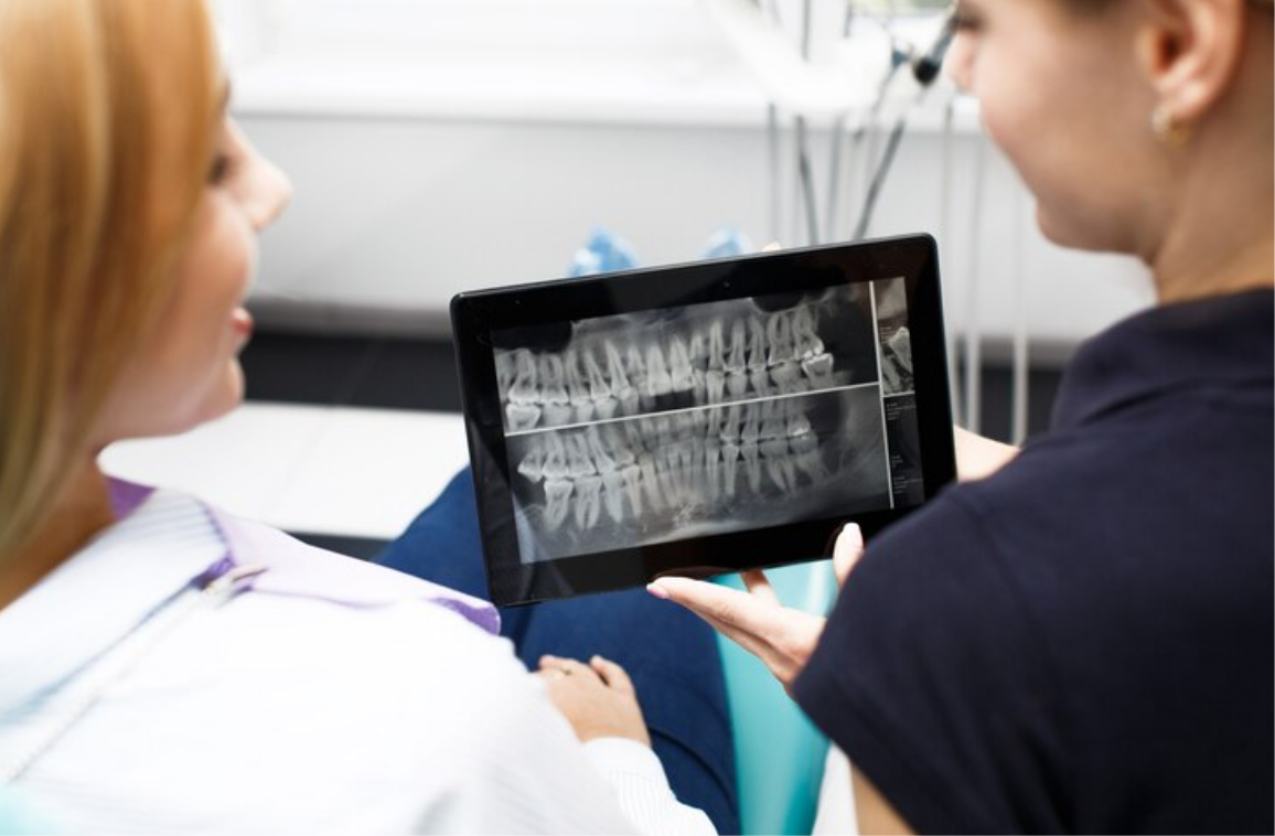 CBCT scan and its benefits