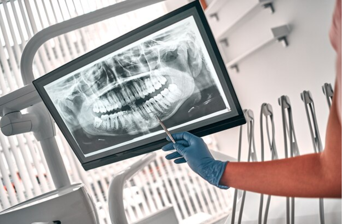 Types of dental radiology and their benefits