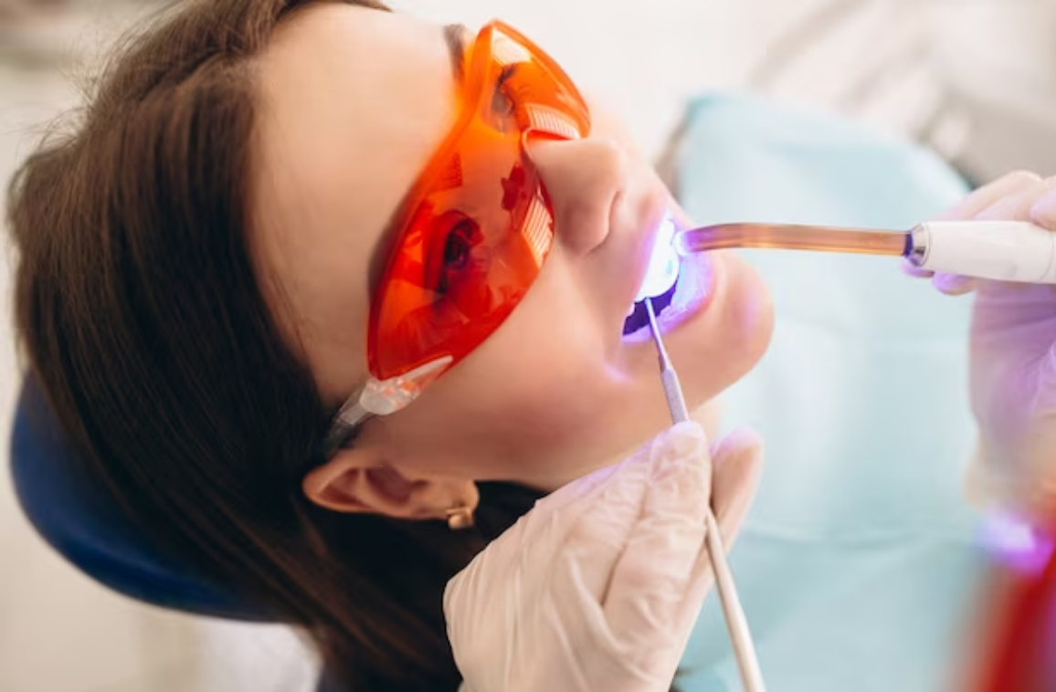 Different Types of Laser Dentistry and Their Advantages