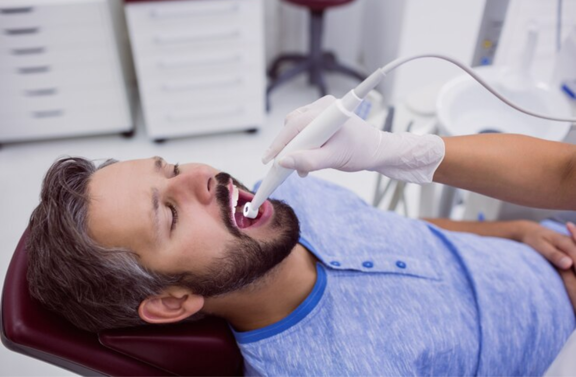 7 common questions about root canal treatment (RCT)