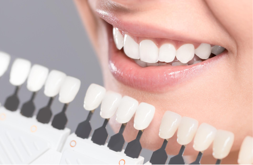 Cosmetic dentistry: what is it? Procedures and Types