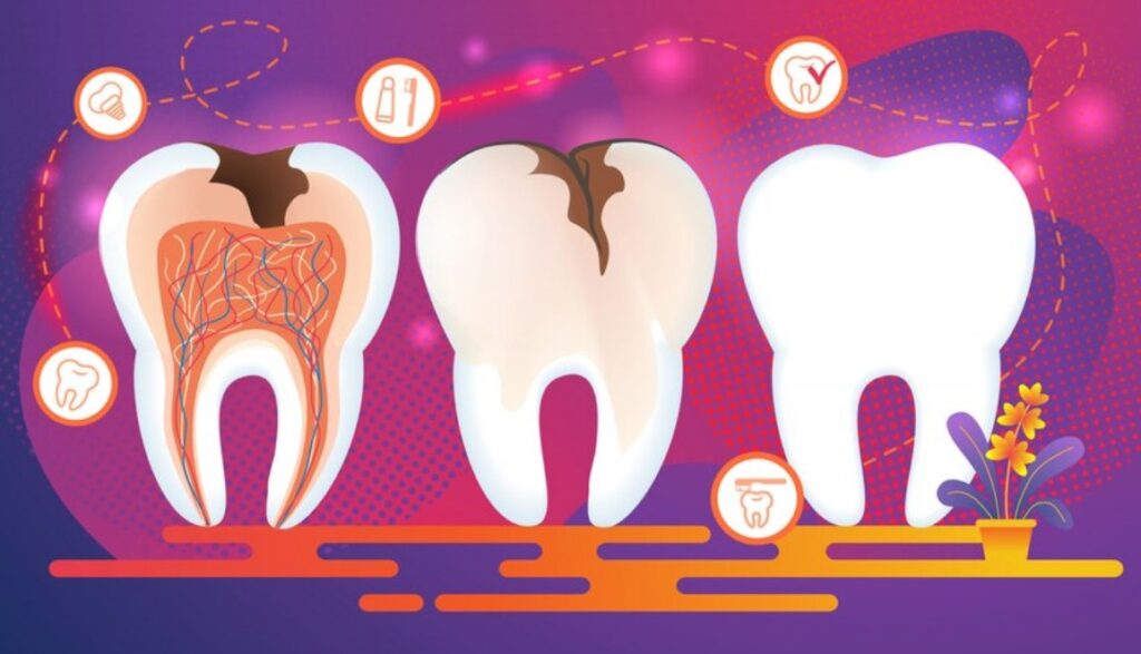 Protecting Your Smile: Tips to Guard Against Various Types of Teeth Diseases