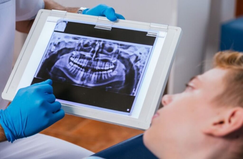 Role of Digital Scanning in Invisalign Treatment