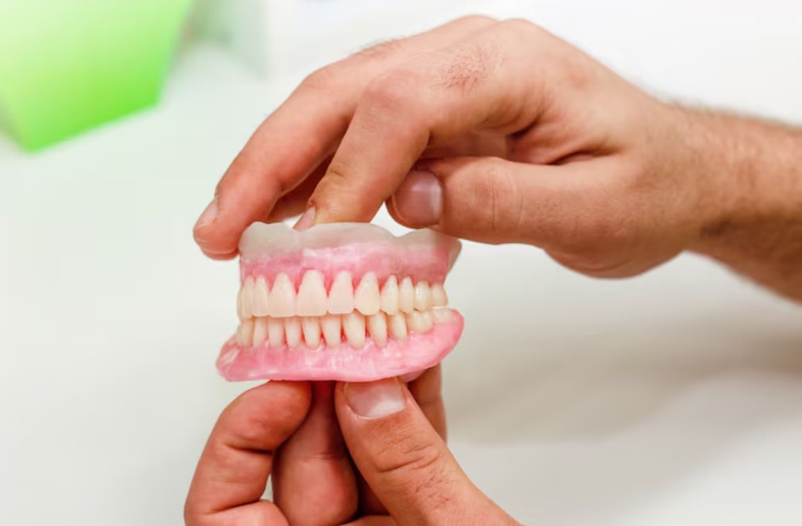 What are dentures? Denture Types and Their Benefits