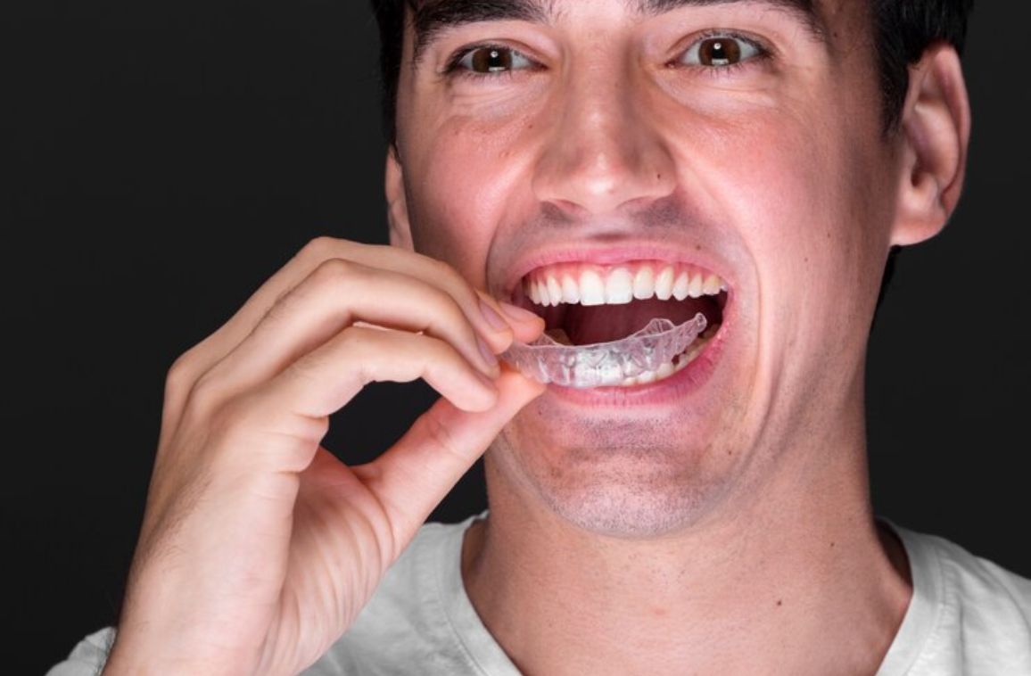 Can Invisalign Correct Crossbite ? Pros and Cons