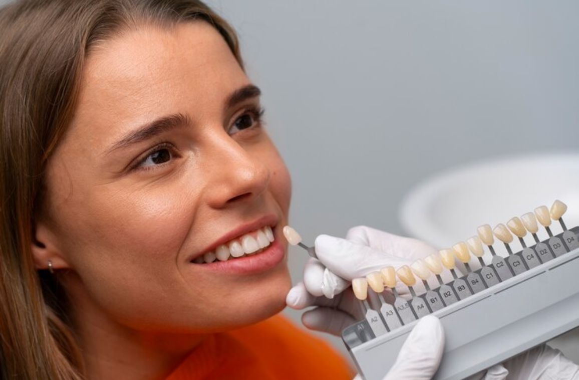 Dental Veneers Benefits, Procedure, and Results