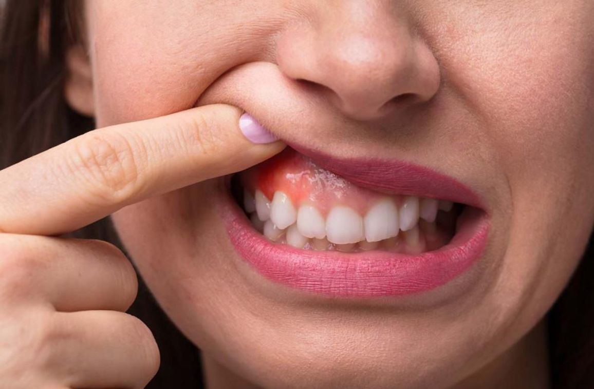 Common Gum teeth problems not to be ignored