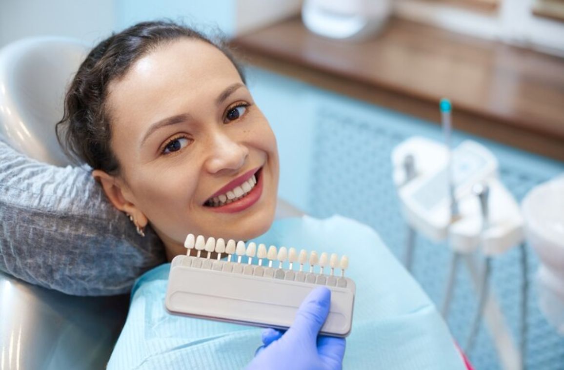 Dental Veneers Benefits, Procedure, and Results